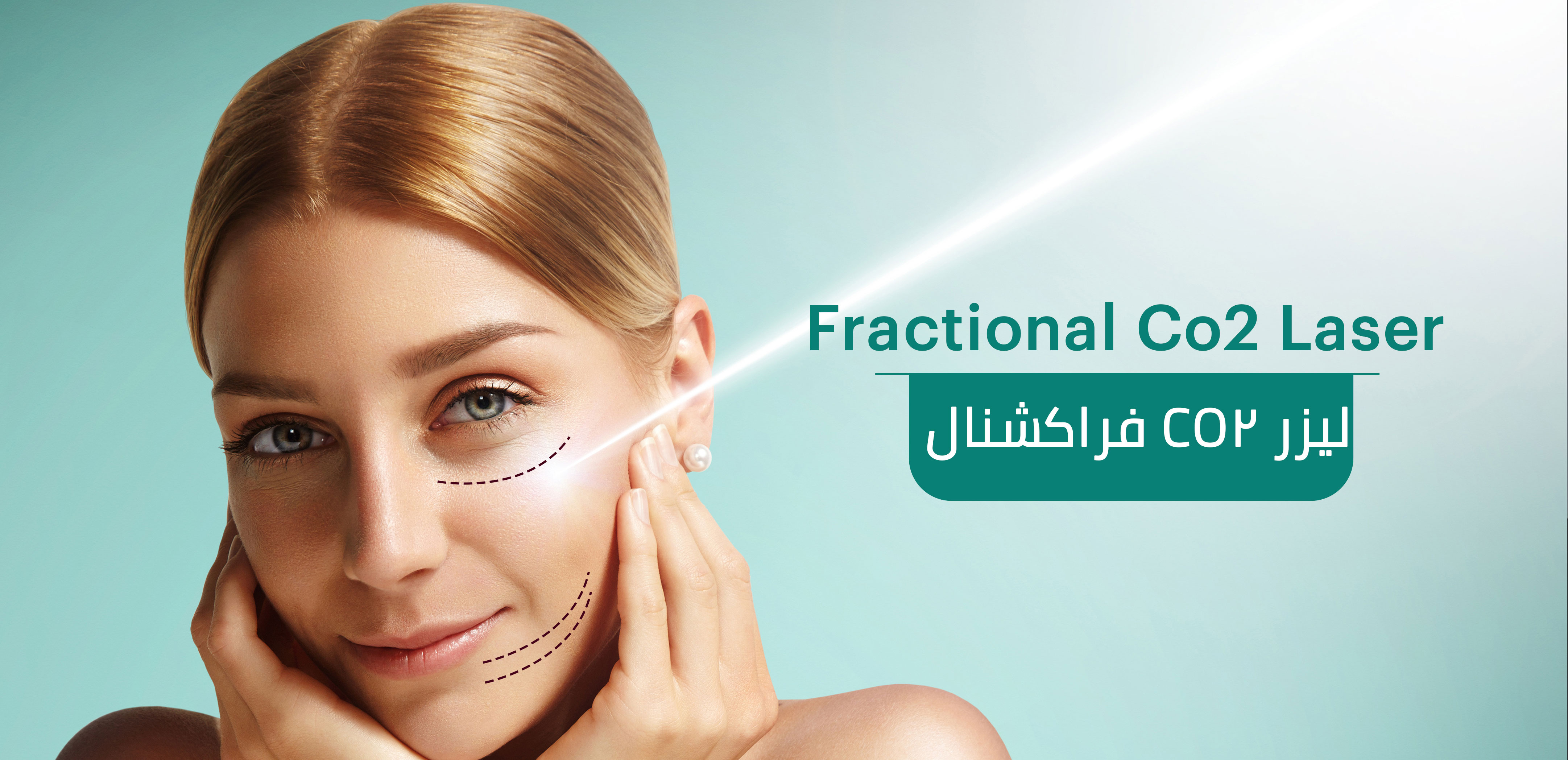 WHAT IS FRACTIONAL CO2 LASER?