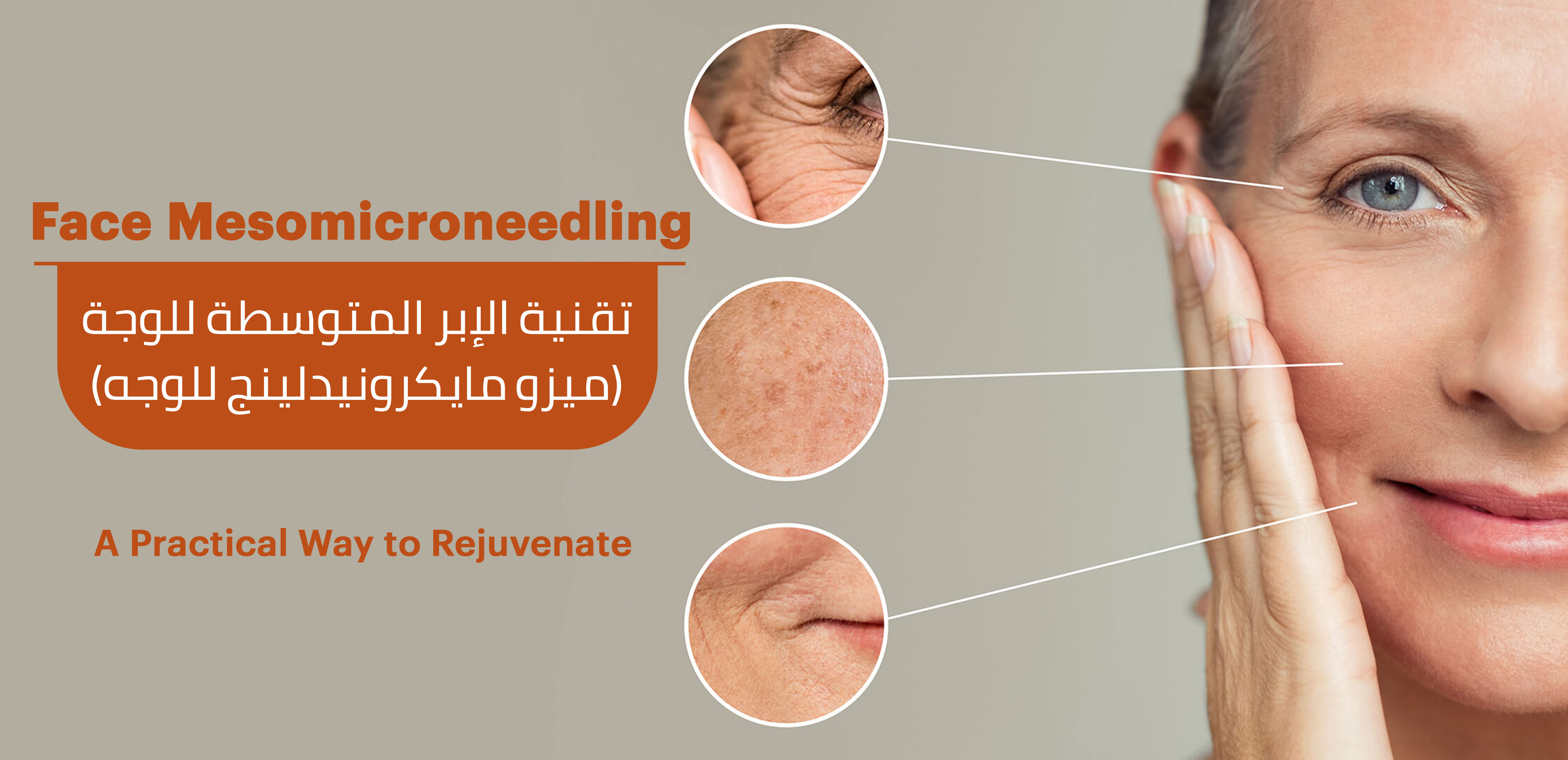  FACE MICRONEEDELING