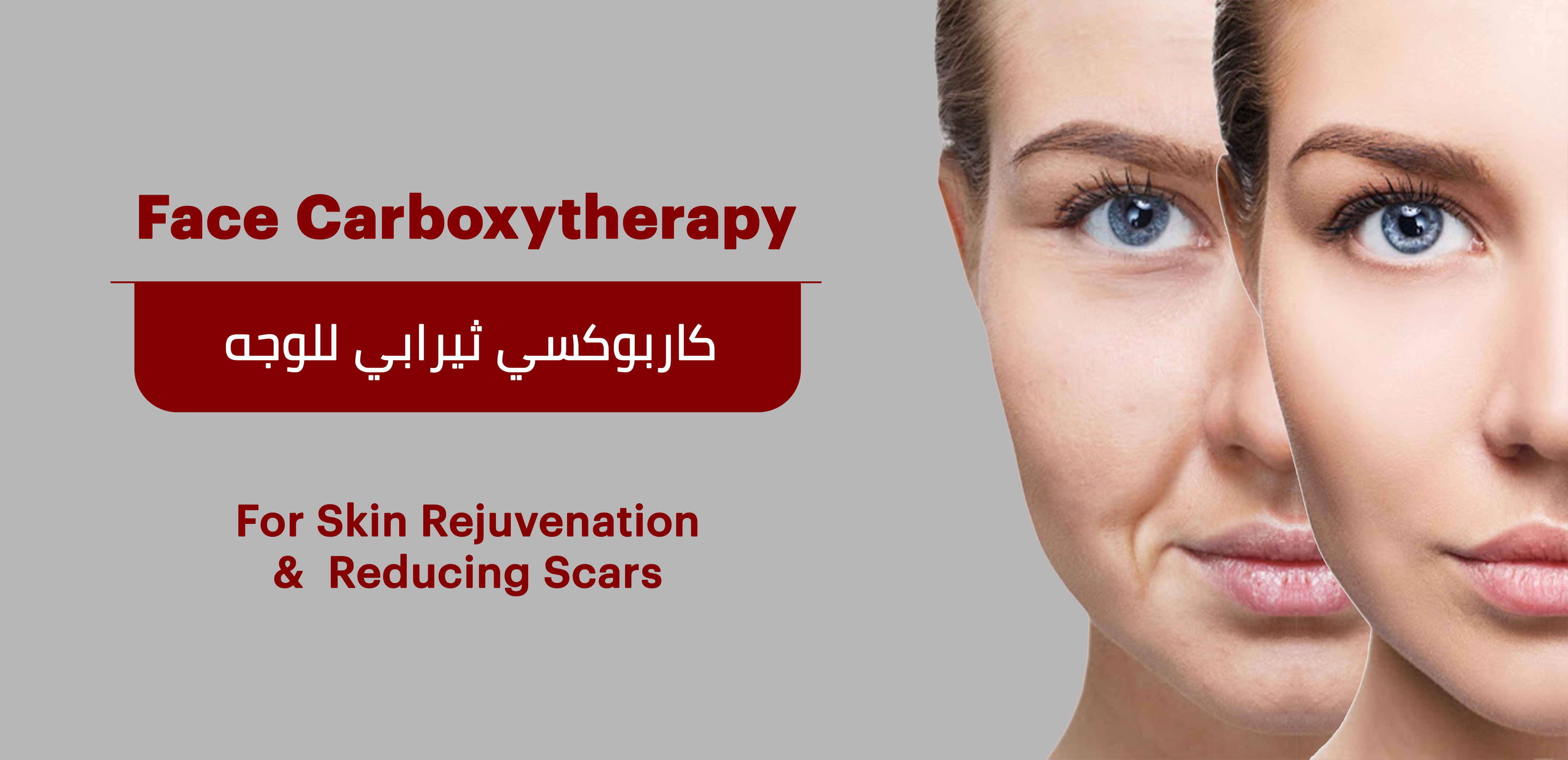 FACE CARBOXYTHERAPY 