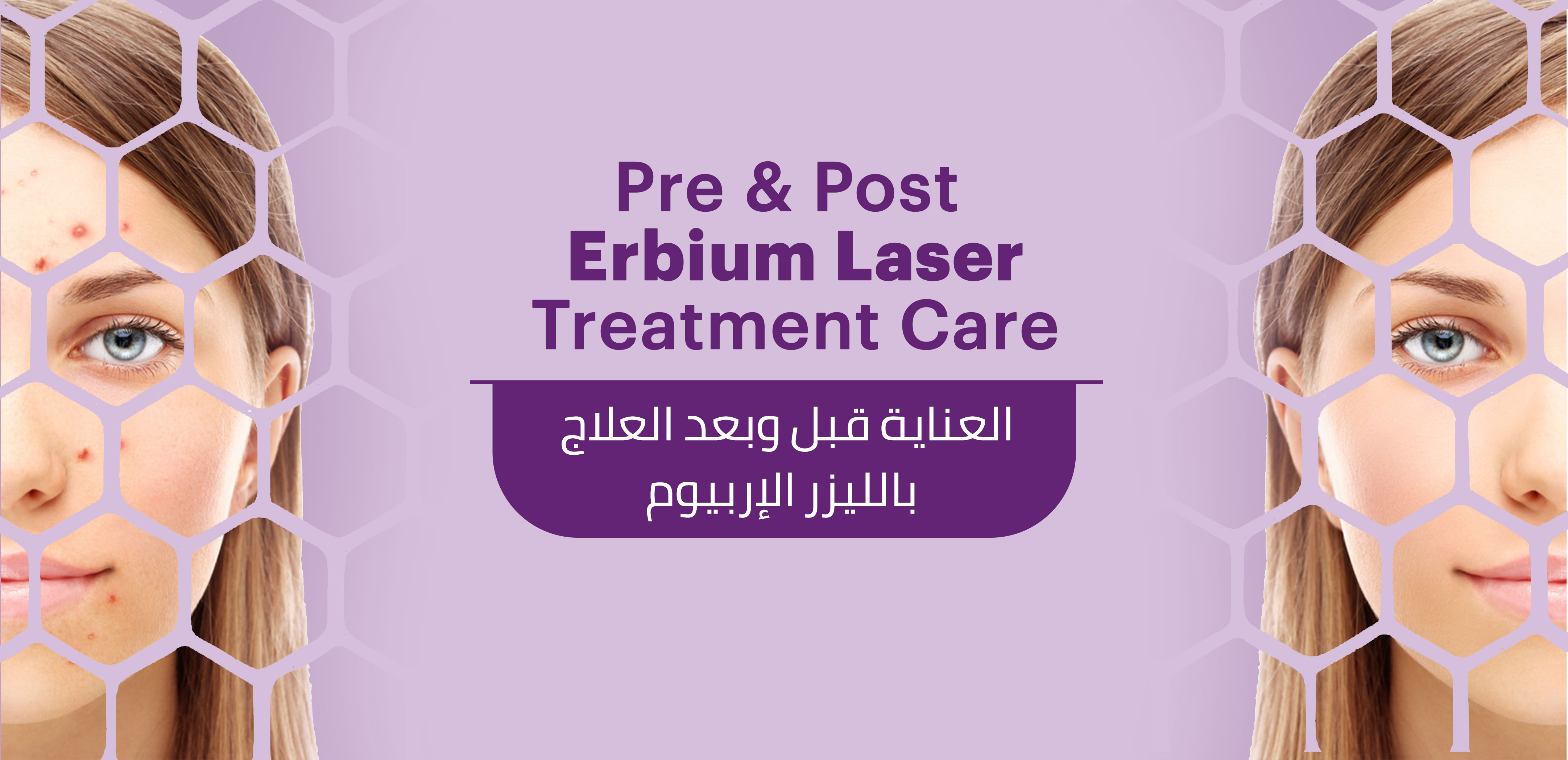 PRE & POST ERBIUM LASER TREATMENT INSTRUCTION