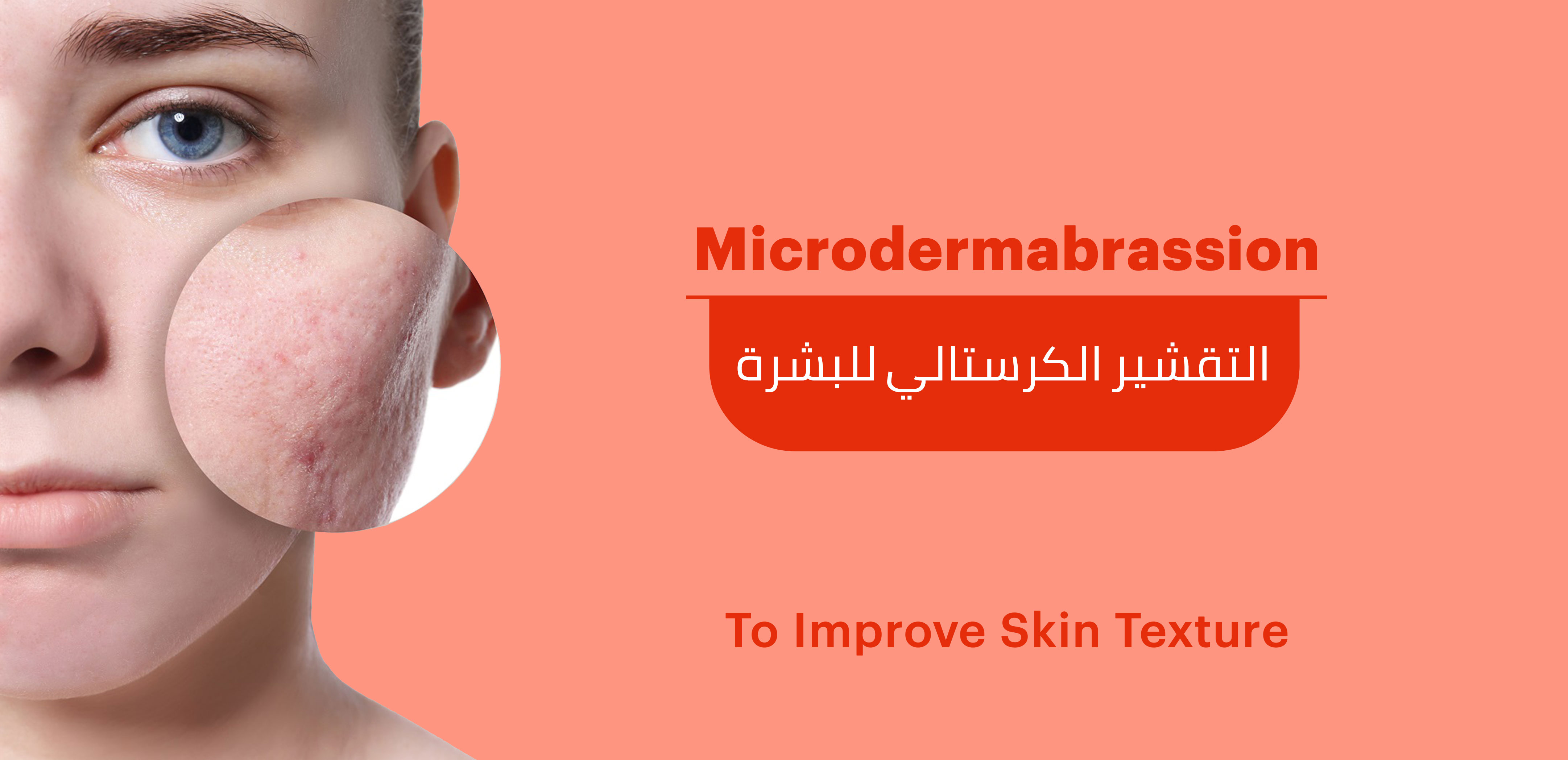 WHAT IS MICRODERMABRASION?