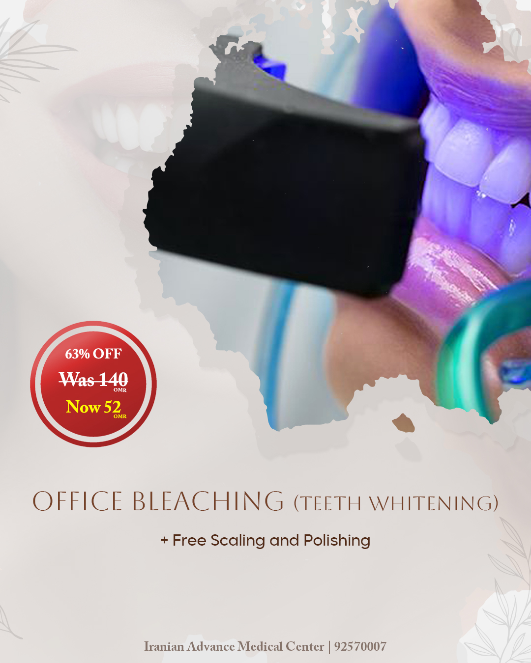 Hollywood Smile | Office Bleaching