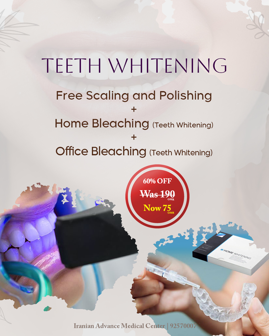 Hollywood Smile | Teeth Whitening